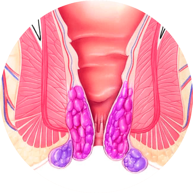 Gelarex alivia los síntomas desde el primer uso